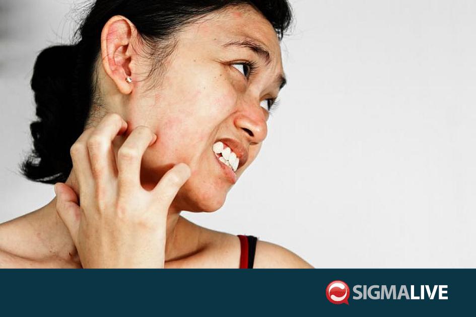 Η φαγούρα είναι κολλητική σαν το χασμουρητό! - Sigmalive