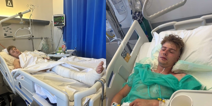 Σε κρίσιμη κατάσταση 24χρονος πατέρας - Έπεσε από μπαλκόνι ενώ ήταν μεθυσμένος