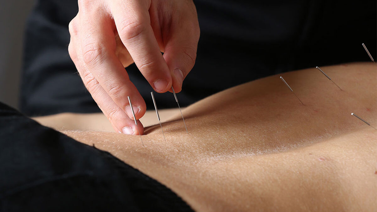 ΟΣΑΚ και ΕΒΦΚ ζητούν απόσυρση πρότασης νόμου για φυσικοπαθητική και βελονισμό