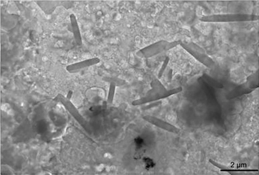 Νέα μελέτη: Πώς επηρεάζουν τον άνθρωπο τα μικροπλαστικά που «τρώμε» (ΒΙΝΤΕΟ)