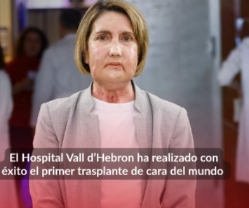 Ισπανία: Μεταμόσχευση προσώπου με δότρια γυναίκα που υποβλήθηκε σε ευθανασία