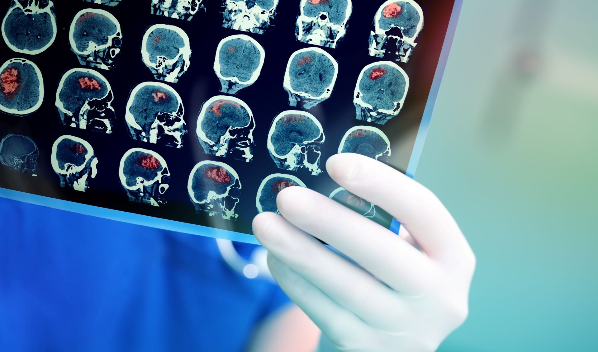 Με μια απλή εξέταση αίματος θα ανιχνεύονται καρκίνοι και άλλες ασθένειες