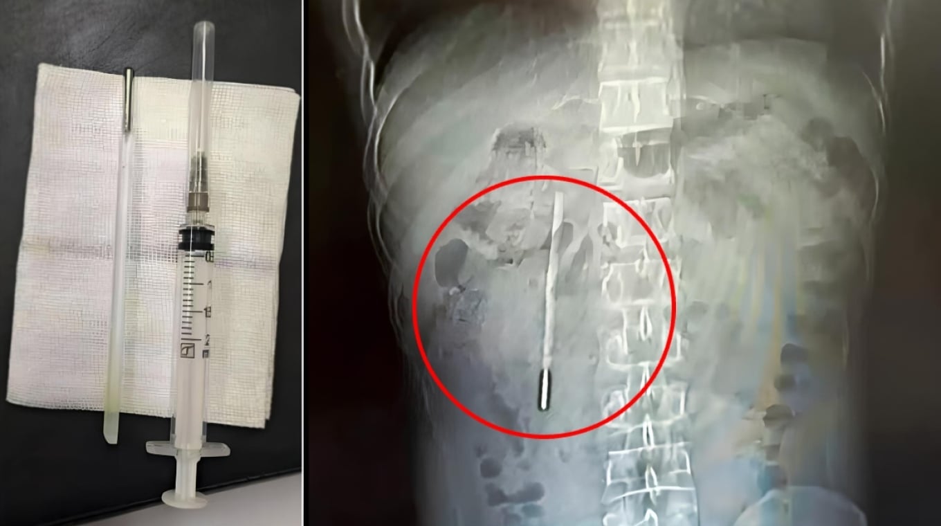 Ά&nu;&delta;&rho;&alpha;&sigmaf; &zeta;&omicron;ύ&sigma;&epsilon; &epsilon;&pi;ί 20 &chi;&rho;ό&nu;&iota;&alpha; &mu;&epsilon; έ&nu;&alpha;... &theta;&epsilon;&rho;&mu;ό&mu;&epsilon;&tau;&rho;&omicron; &sigma;&tau;&omicron; &sigma;ώ&mu;&alpha; &tau;&omicron;&upsilon; (&Phi;&Omega;&Tau;&Omicron;)