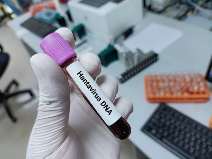 &Epsilon;&pi;&iota;&beta;ά&tau;&eta;&sigmaf; &mu;&epsilon; &chi;&alpha;&nu;&tau;&alpha;ϊό &epsilon;&pi;&iota;&chi;&epsilon;ί&rho;&eta;&sigma;&epsilon; &nu;&alpha; &tau;&alpha;&xi;&iota;&delta;έ&psi;&epsilon;&iota; &sigma;&tau;&eta;&nu; &Omicron;&lambda;&lambda;&alpha;&nu;&delta;ί&alpha; &alpha;&pi;ό &tau;&eta; &Nu;ό&tau;&iota;&alpha; &Alpha;&phi;&rho;&iota;&kappa;ή