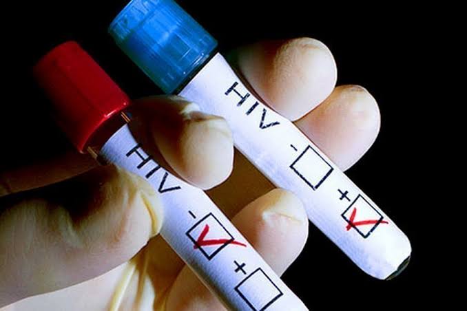 &Delta;&iota;&alpha;&psi;&epsilon;ύ&delta;&epsilon;&iota; &alpha;&nu;&alpha;&rho;&tau;ή&sigma;&epsilon;&iota;&sigmaf; &gamma;&iota;&alpha; &nu;έ&alpha; &kappa;&rho;&omicron;ύ&sigma;&mu;&alpha;&tau;&alpha; HIV &kappa;&alpha;&tau;&epsilon;&chi;ό&mu;&epsilon;&nu;&alpha;, &tau;&omicron; &laquo;&upsilon;&pi;&omicron;&upsilon;&rho;&gamma;&epsilon;ί&omicron; &upsilon;&gamma;&epsilon;ί&alpha;&sigmaf;&raquo;