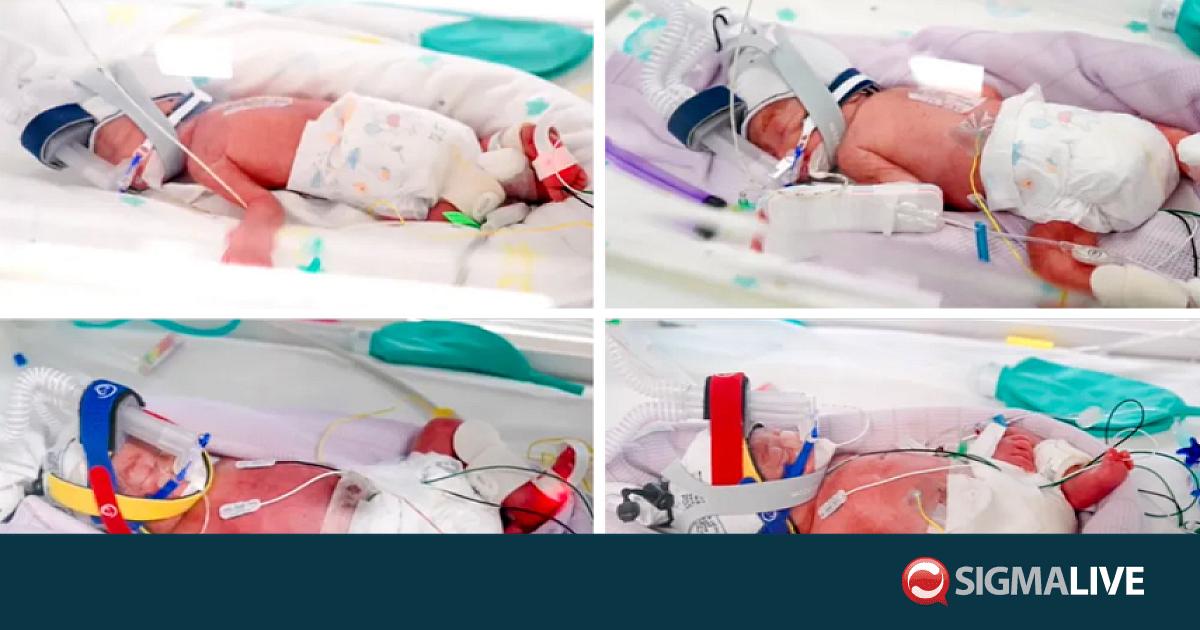 &Mu;&iota;&alpha; &pi;&iota;&theta;&alpha;&nu;ό&tau;&eta;&tau;&alpha; &sigma;&tau;&alpha; 15 &epsilon;&kappa;&alpha;&tau;&omicron;&mu;&mu;ύ&rho;&iota;&alpha;: &Alpha;&upsilon;&sigma;&tau;&rho;&alpha;&lambda;ή &gamma;έ&nu;&nu;&eta;&sigma;&epsilon; &pi;&alpha;&nu;&omicron;&mu;&omicron;&iota;ό&tau;&upsilon;&pi;&alpha; &tau;&epsilon;&tau;&rho;ά&delta;&upsilon;&mu;&alpha;